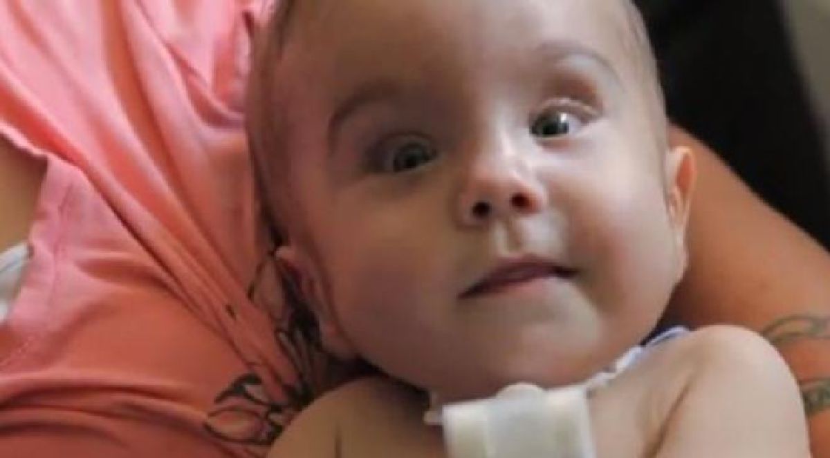Un bébé de 14 mois sauvé : grâce à l’impression 3D