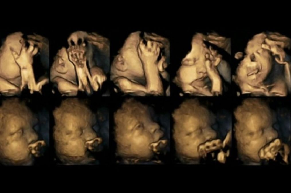 Des échographies en 4D montrent en images l’effet de la nicotine sur les foetus