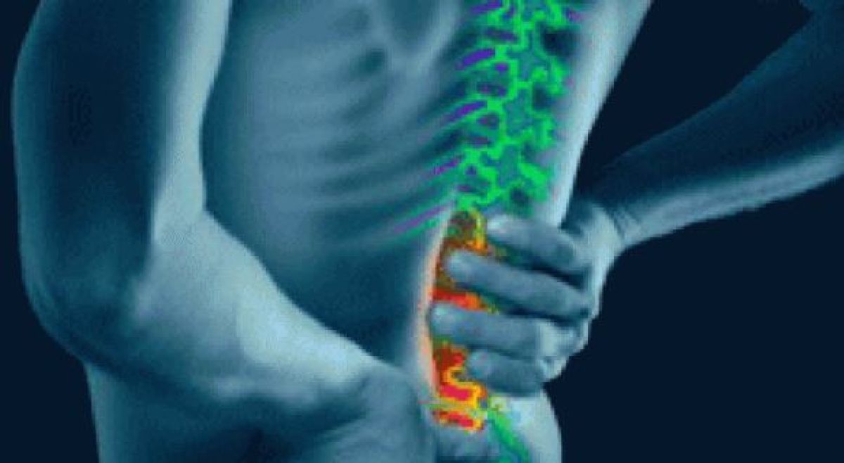 5 signes d’un nerf comprimé dans votre dos