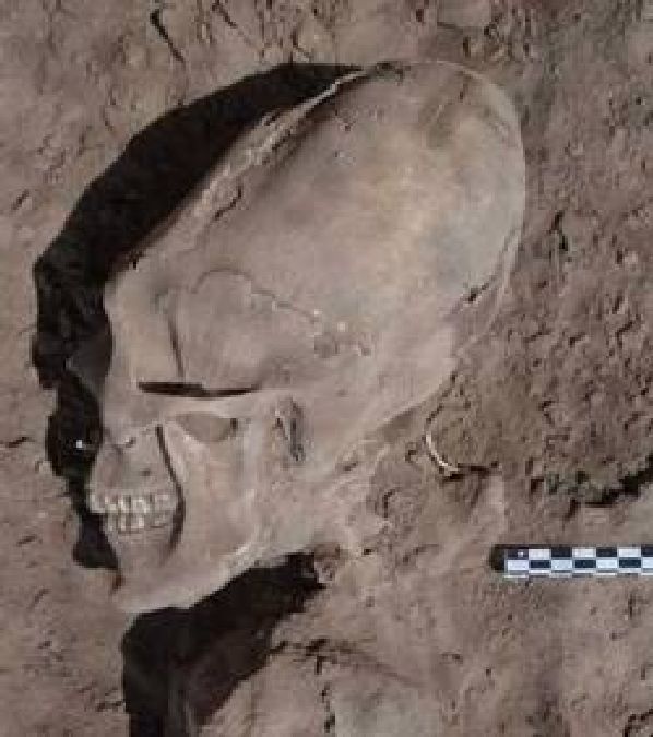 D’étranges crânes largement déformés découverts au Mexique