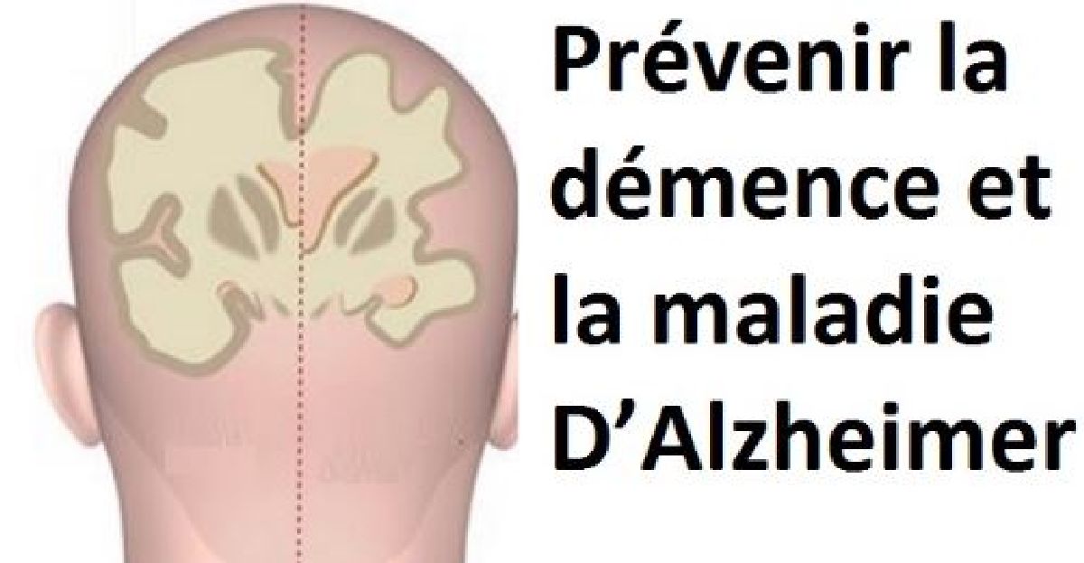 9 Bonnes habitudes à adopter immédiatement pour vous protéger et prévenir la démence et  la maladie D’Alzheimer !