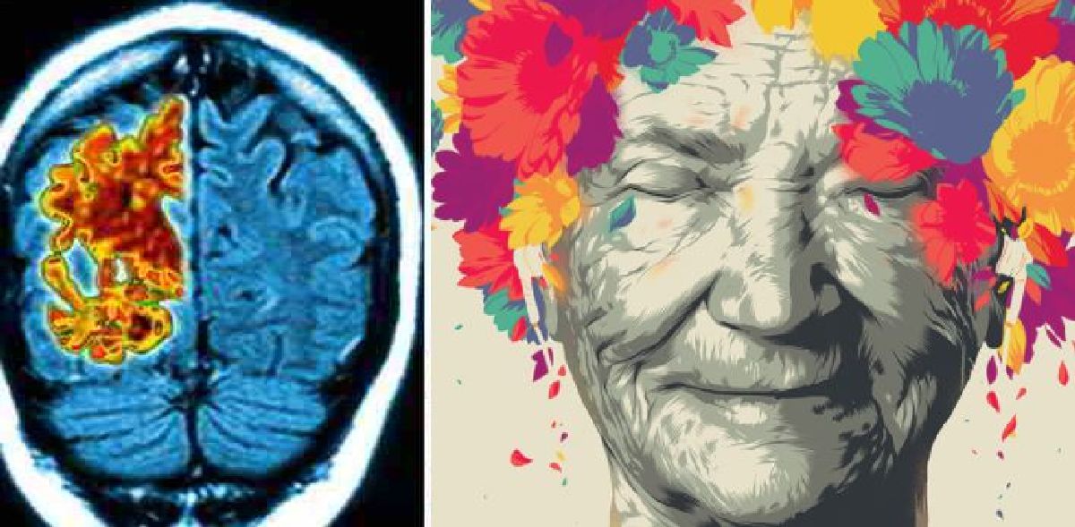 Les 7 stades de l’Alzheimer  selon l’Échelle de Reisberg