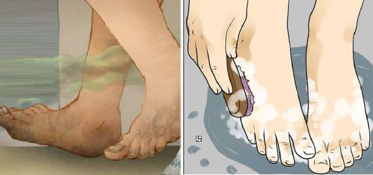 Si vous avez les pieds malodorants, découvrez ces astuces pour y remédier !