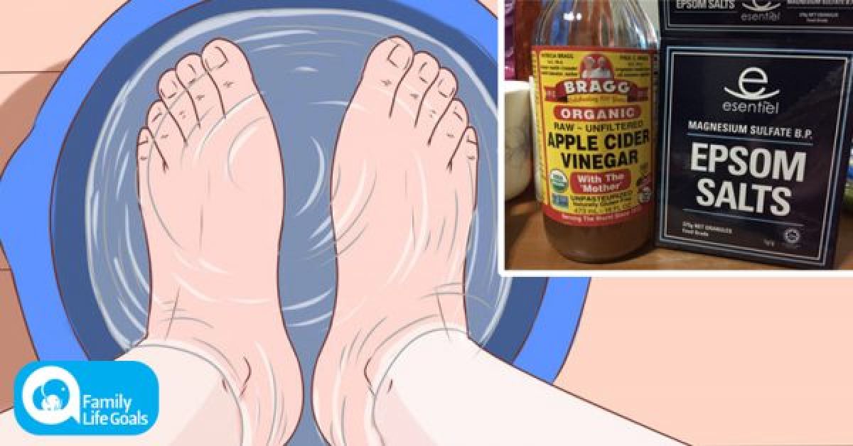 Bain de pied à base de deux ingrédients naturel  pour éliminer la douleur des pieds en 20 minutes