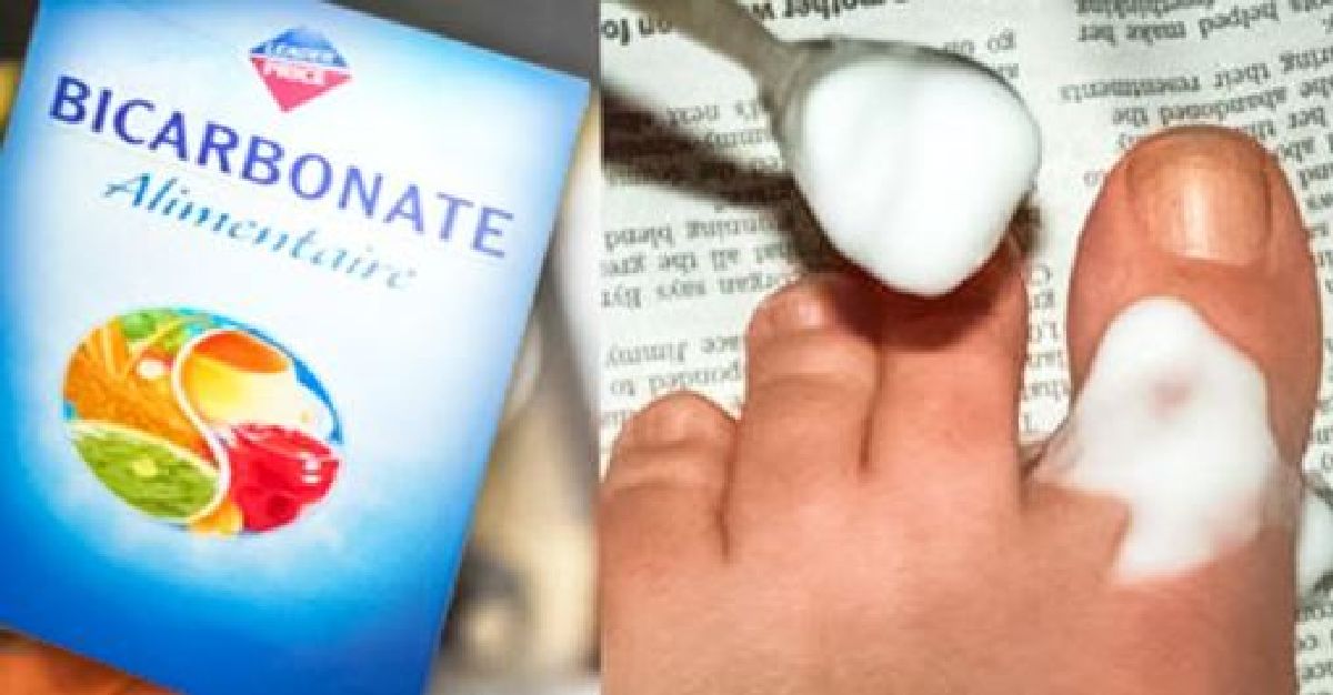 Lavez-vous les pieds avec le bicarbonate de soude2 fois par semaine, et admirez le résultat !