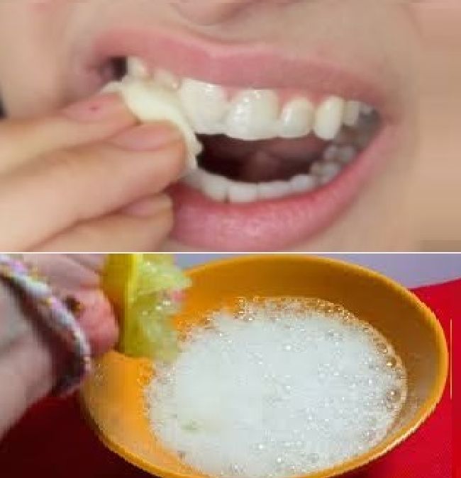 Blanchir vos dents jaunes en moins de 2 minutes!