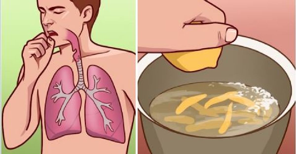 Essayez ce remède à la maison pour traiter la bronchite et arrêtez les attaques de toux douloureuses