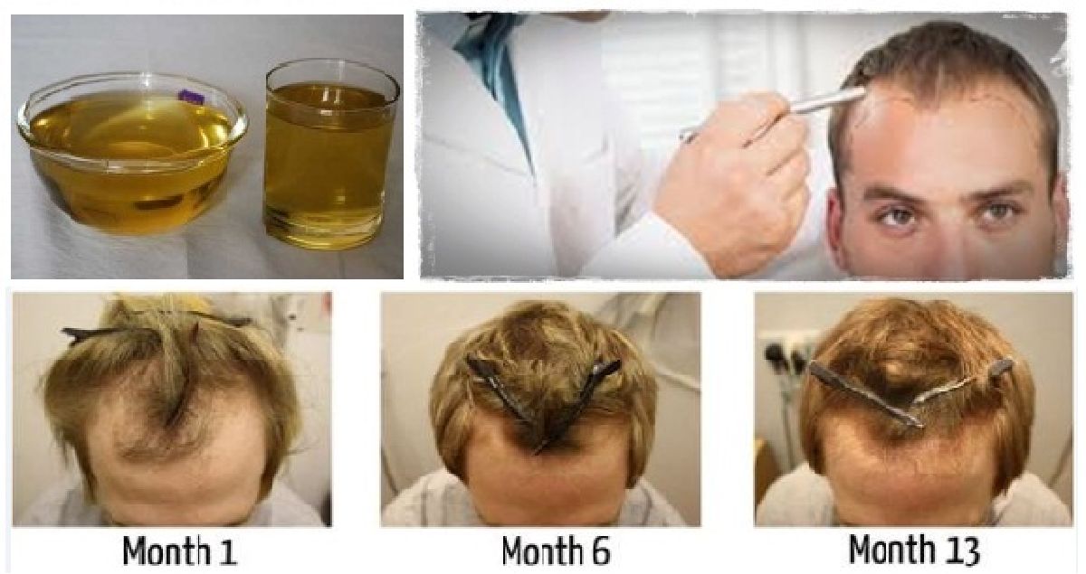 Solution avec un seul ingrédient pour préserver vos cheveux et les faire repousser!