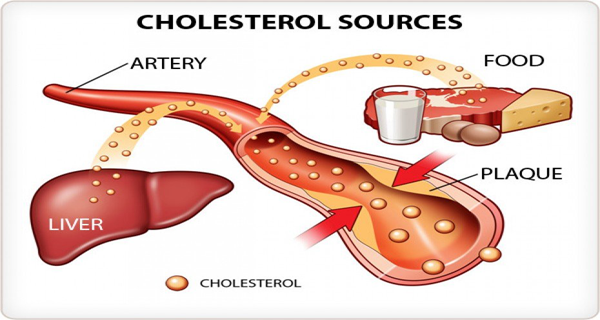 Remèdes faits maison pour réduire l’excès de cholestérol.