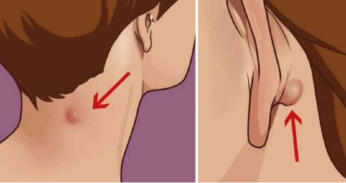 Ce que vous devait savoir si vous découvrez une enflure dans le cou ou derrière l’oreille