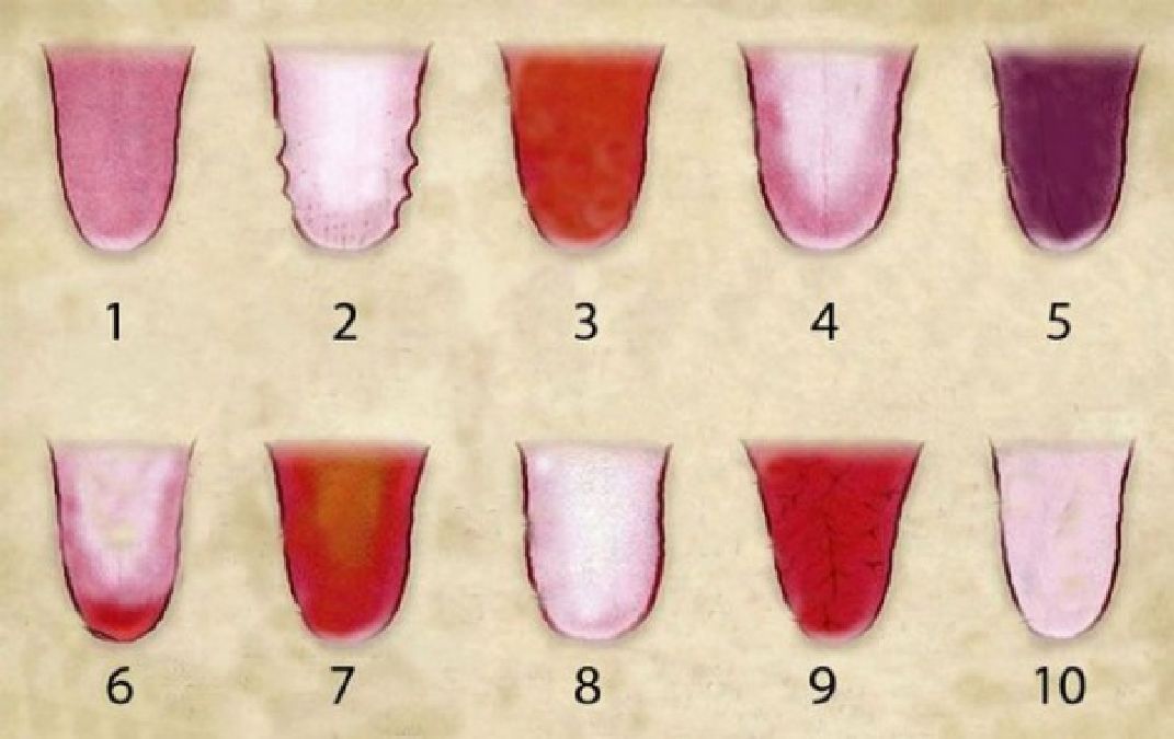 Comment la couleur de votre langue révèle votre santé