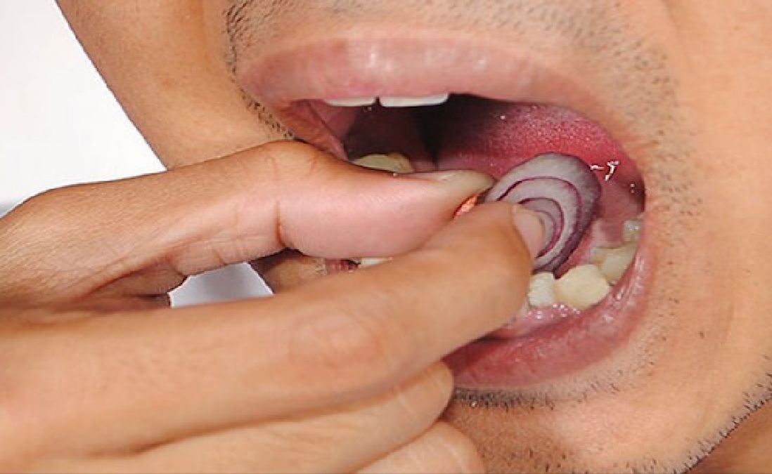 Comment traiter vos rages de dents naturellement?