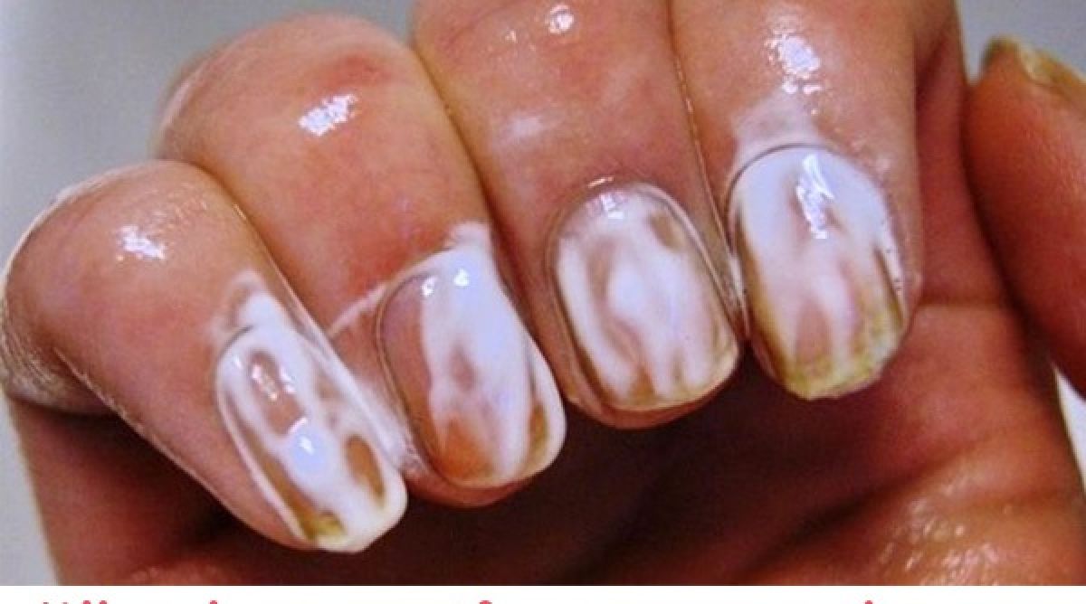 Voici ce qui se passe si vous mettez du dentifrice sur vos ongles : le résultat est étonnant