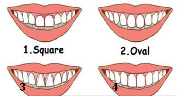 Vos dents en disent plus long sur votre personnalité que ne le savez