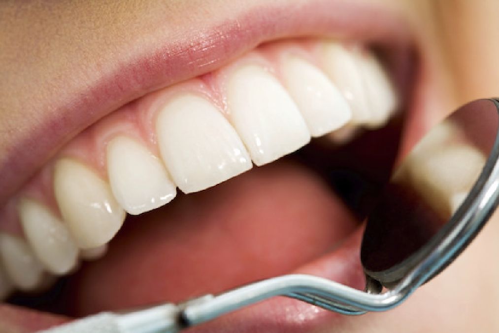 Faites ce test pour savoir si vos dents vous vieillissent, et connaitre leur durée de vie