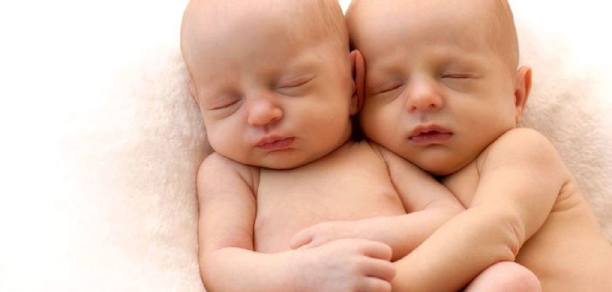Un bébé embrasse sa jumelle qui était en train de mourir: Ce qui est arrivé a choqué le monde entier