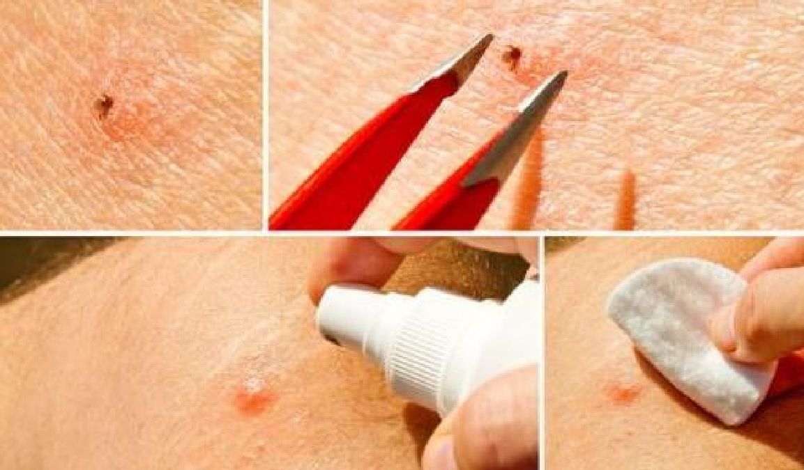 Voici quelques astuces infaillibles pour éliminer les tiques de la peau de vos animaux