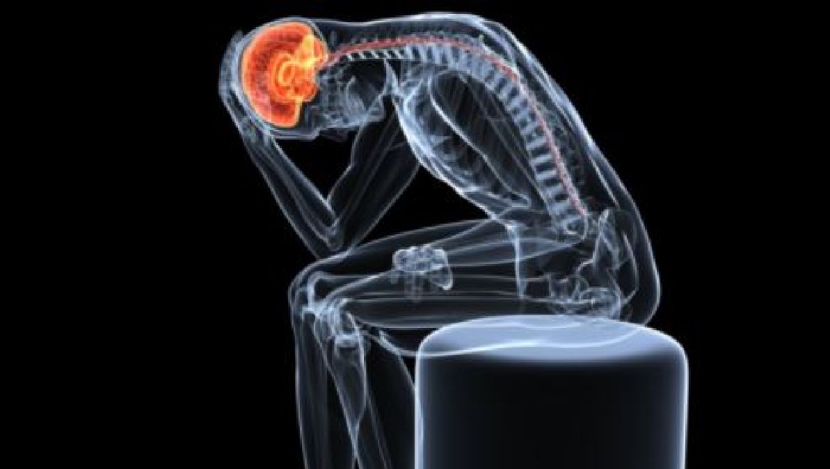 Des aliments qui peuvent aggraver vos migraines