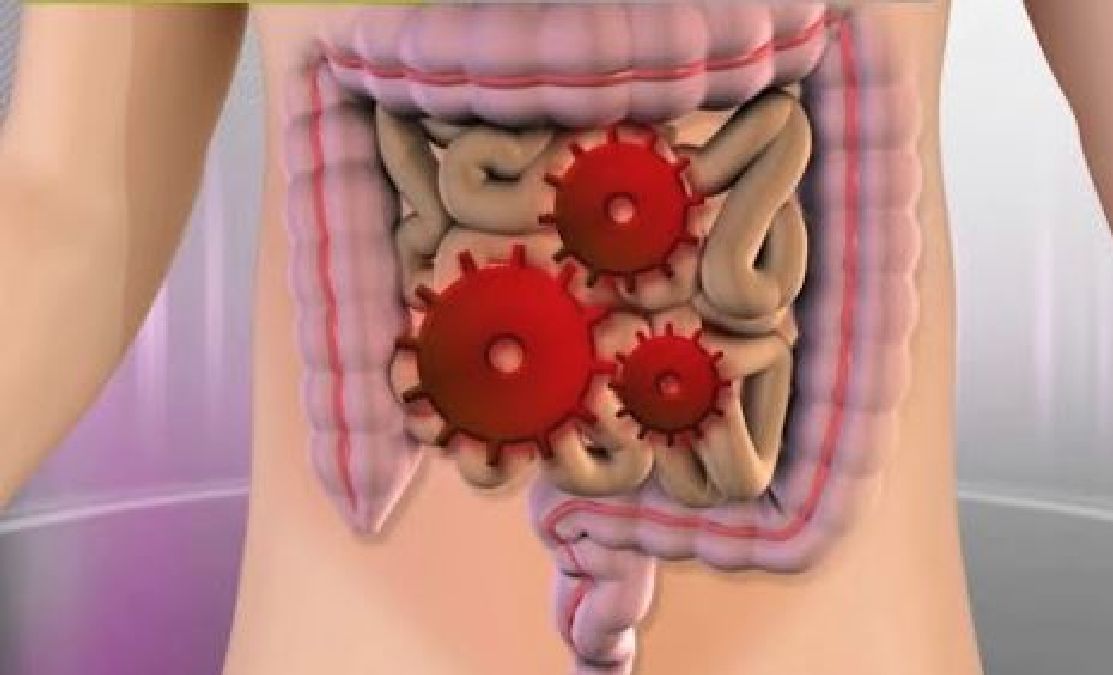 Grippe intestinale : les symptômes et les traitements
