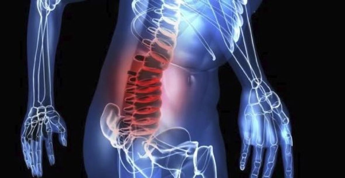 Voici Comment différencier une hernie discale d’une douleur de dos?
