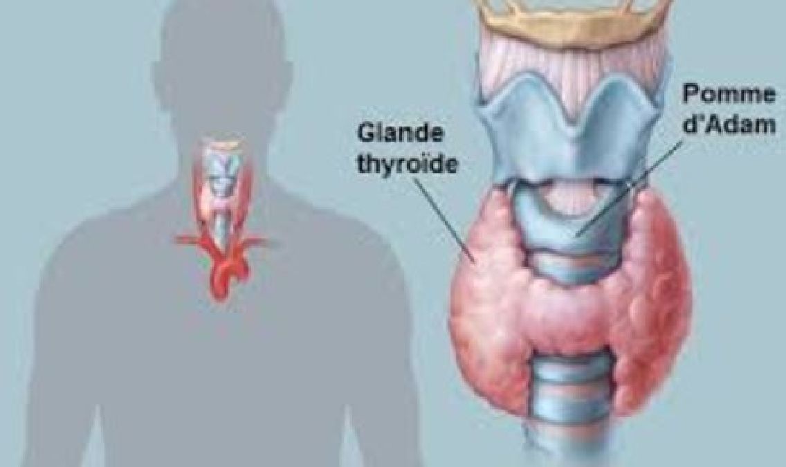 Ce que vous devez savoir sur les troubles thyroïdiens et comment soigner