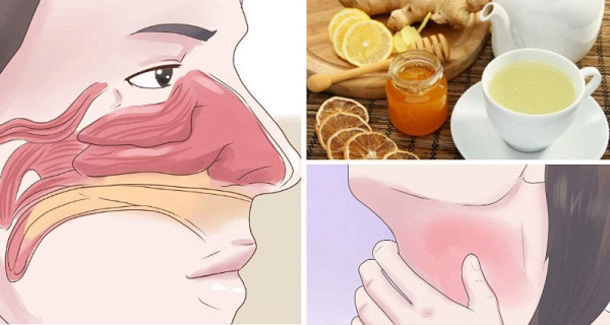 Recettes de boissons faciles qui nettoient les sinus et détruit immédiatement l’inflammation de la gorge