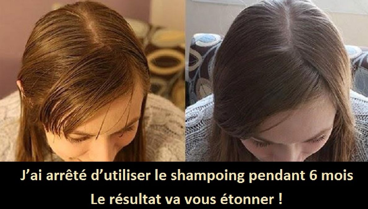 J’ai arrêté d’utiliser le shampoing pendant 6 mois, Le resultat est incroyable