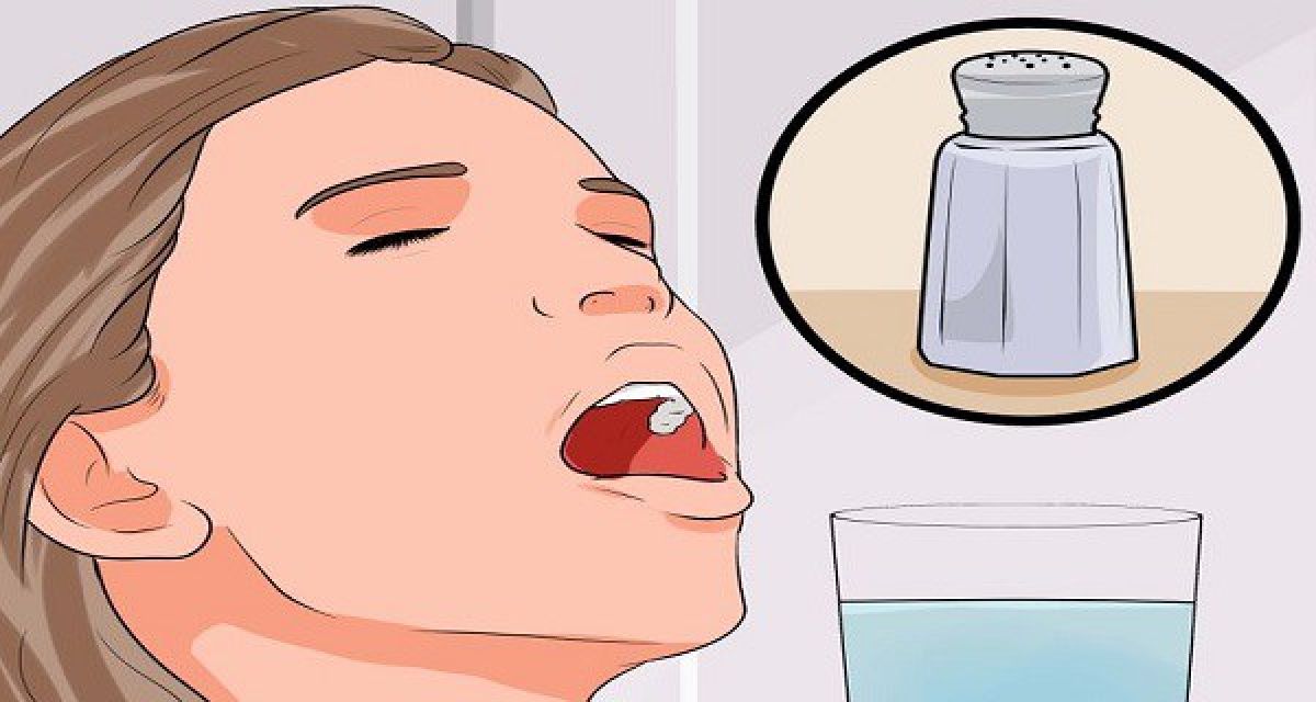La méthode la plus efficace pour guérir une rage de dents rapidement