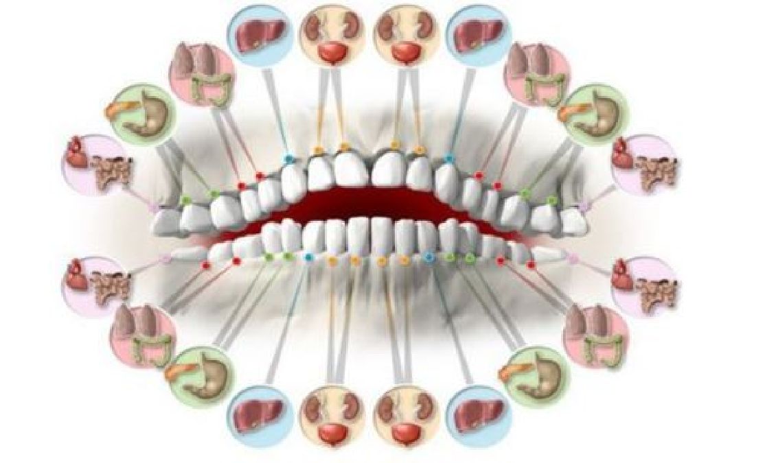 Chacune de vos dents est reliée à un organe du corps, et une douleur dentaire peut révéler un autre problème de santé