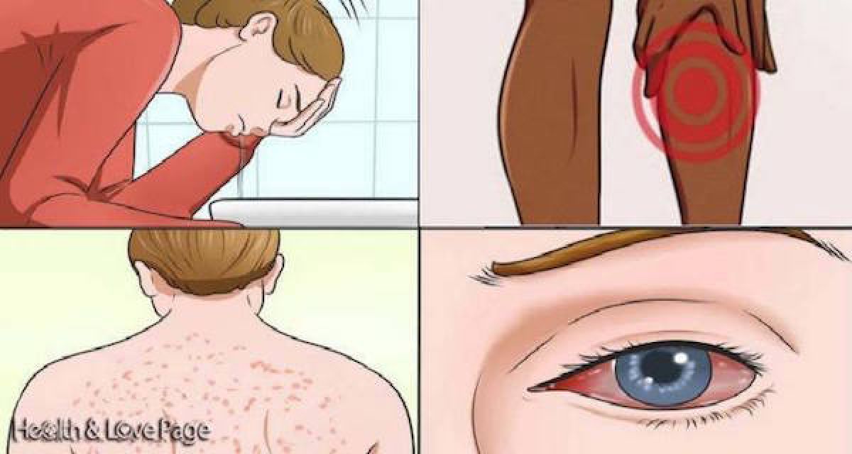 17 signes que la moisissure affecte votre santé