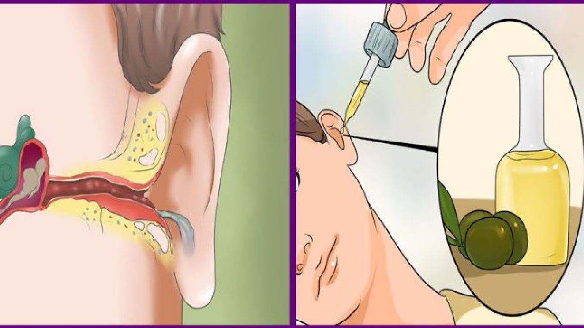 Comment se débarrasser des douleurs et infections aux oreilles naturellement