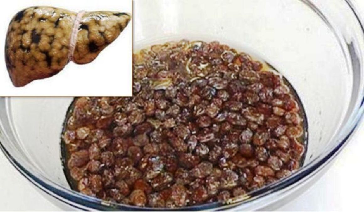 Comment nettoyer votre foie avec des raisins secs et de l’eau