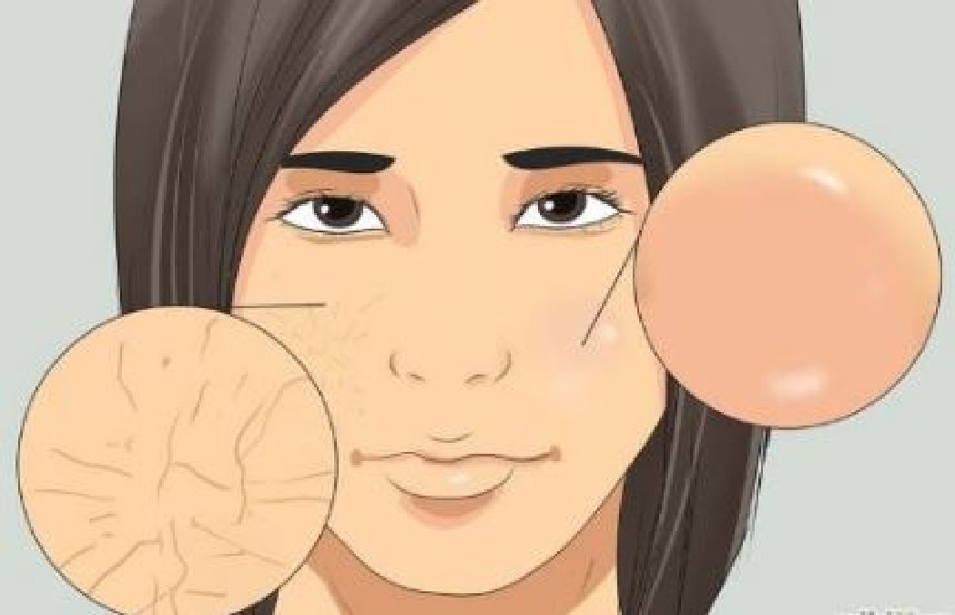 5 signes de déficience en éléments nutritifs visibles sur votre visage
