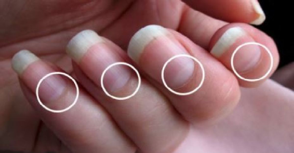 Consultez un médecin en urgence si vous n’avez pas ces formes de demi-lunes sur vos ongles !