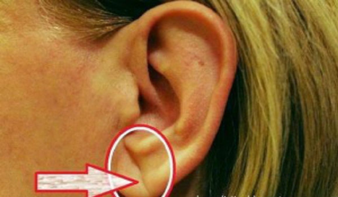 Avez-vous cette caractéristique sur votre oreille? Voilà ce qu’elle signifie …