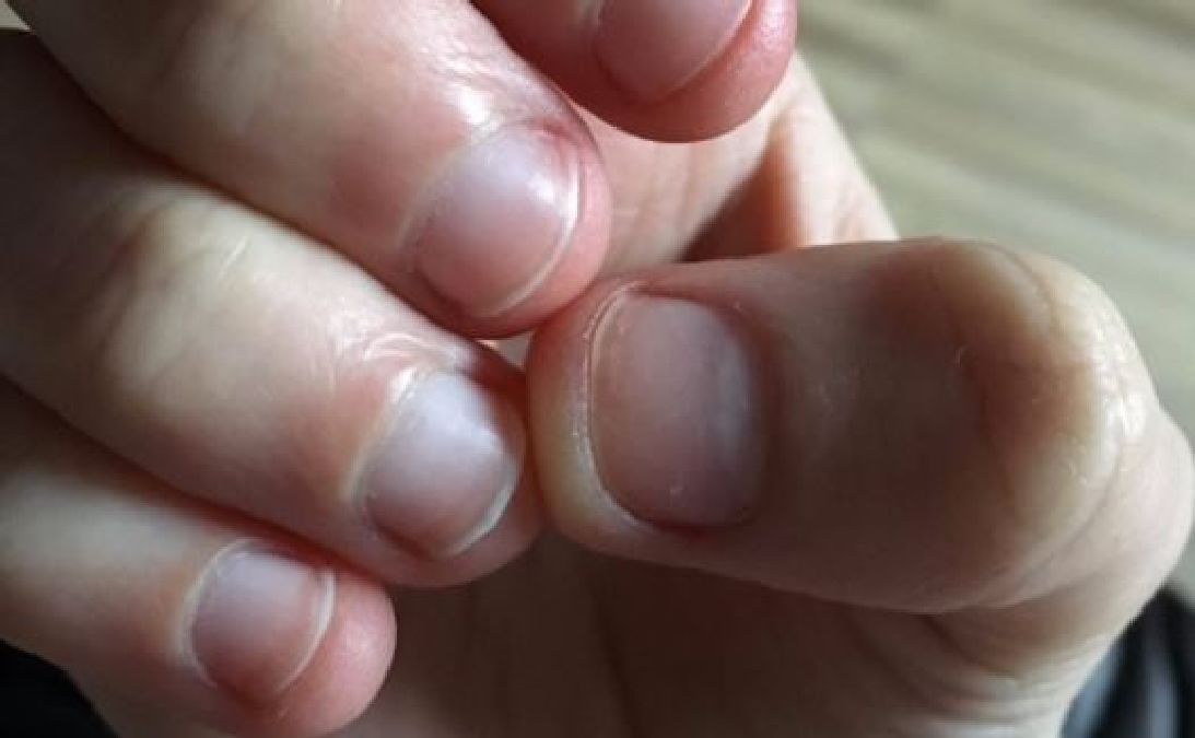 Voici ce qui arrive si vous rongez la peau autour de vos ongles