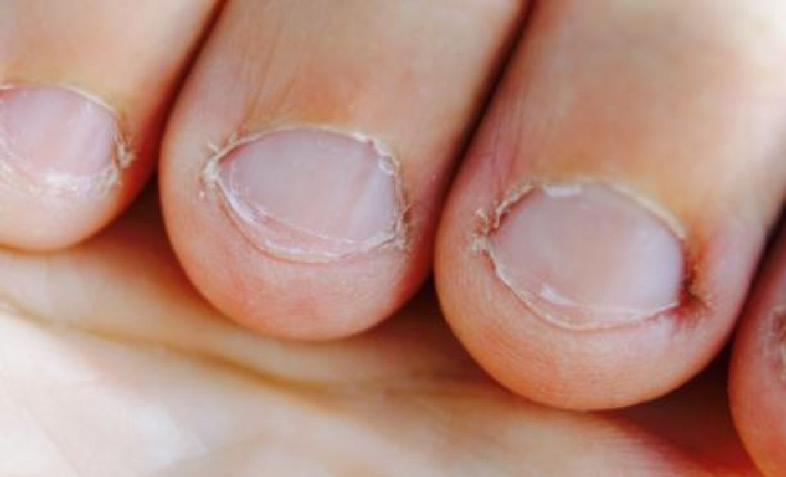 Voici ce que se ronger les ongles révèle sur votre personnalité selon les chercheurs !
