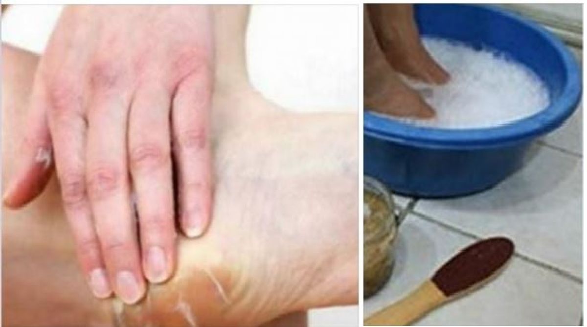 Des soins naturels contre les pieds secs et craquelés efficace en 10 minutes  !