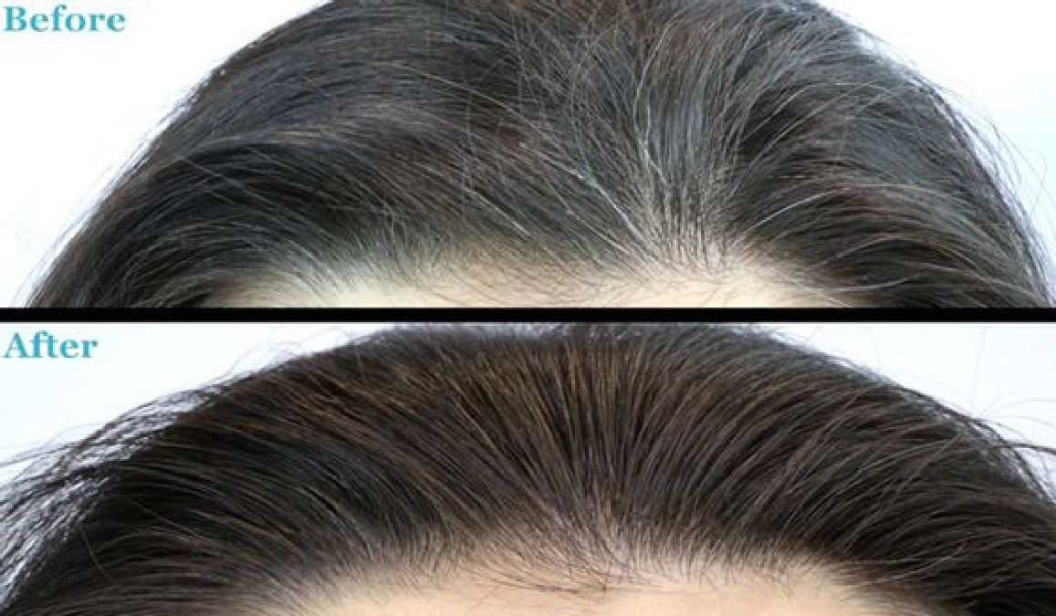 Remèdes maison contre le vieillissement prématuré des cheveux