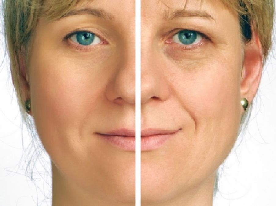 Comment ralentir le vieillissement de la peau
