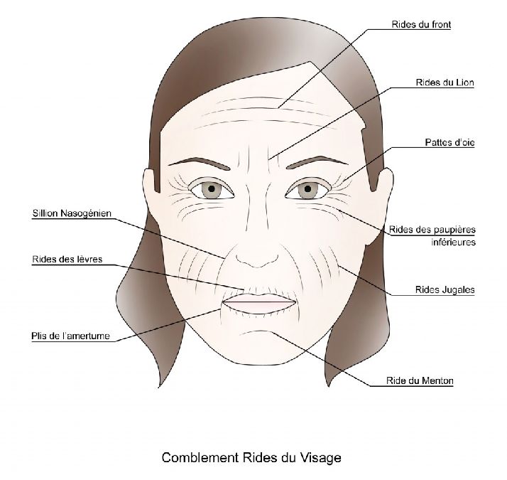 Les rides et les marques de votre visage révèlent des secrets sur votre santé