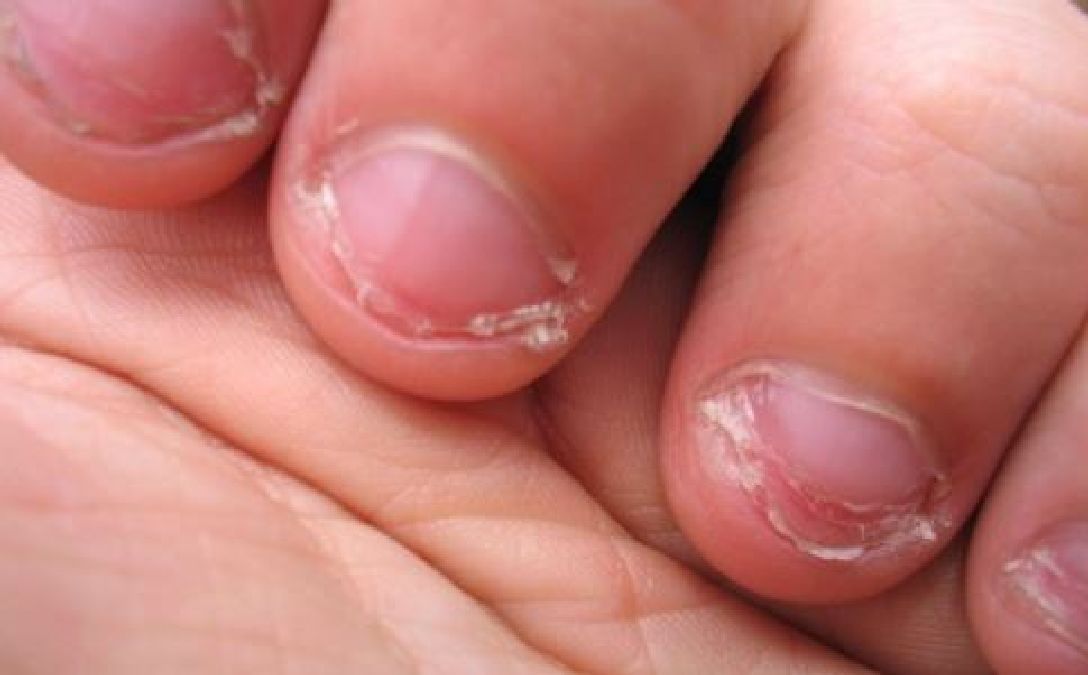 Si vous vous rongez les ongles, c’est un signe de ce trait de personnalité unique