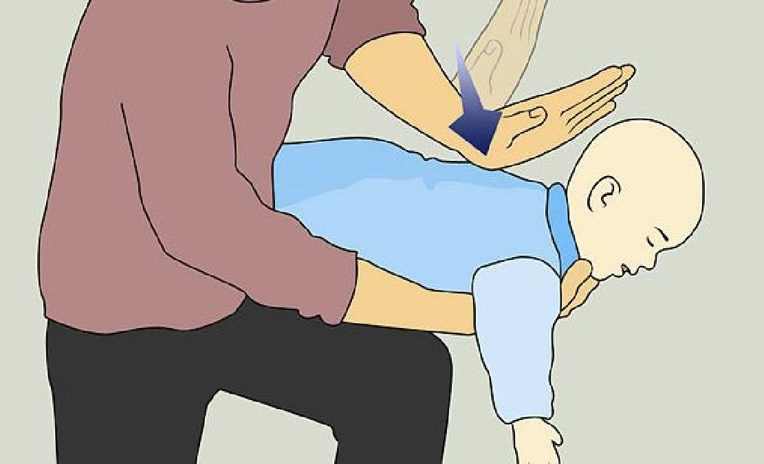 Comment réaliser la technique d’Heimlich sur un bébé