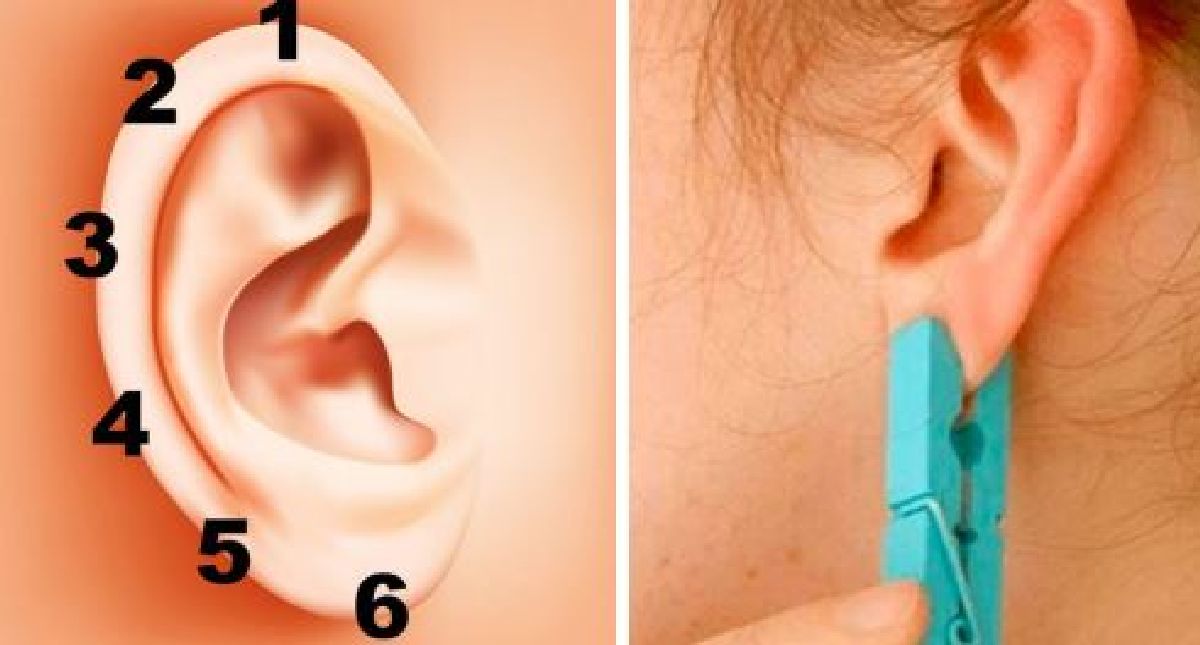 Placez une pince à linge sur votre oreille pendant 20 secondes. Les résultats vous surprendront