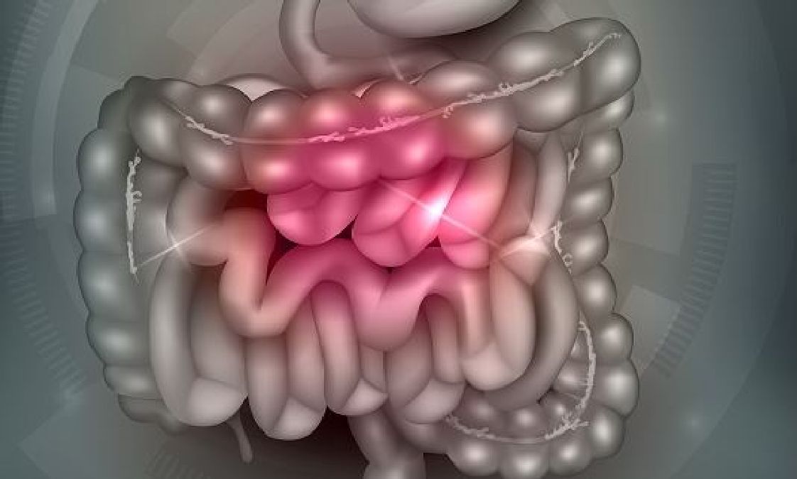Contrer les symptômes du colon irritable grâce à la vitamine D