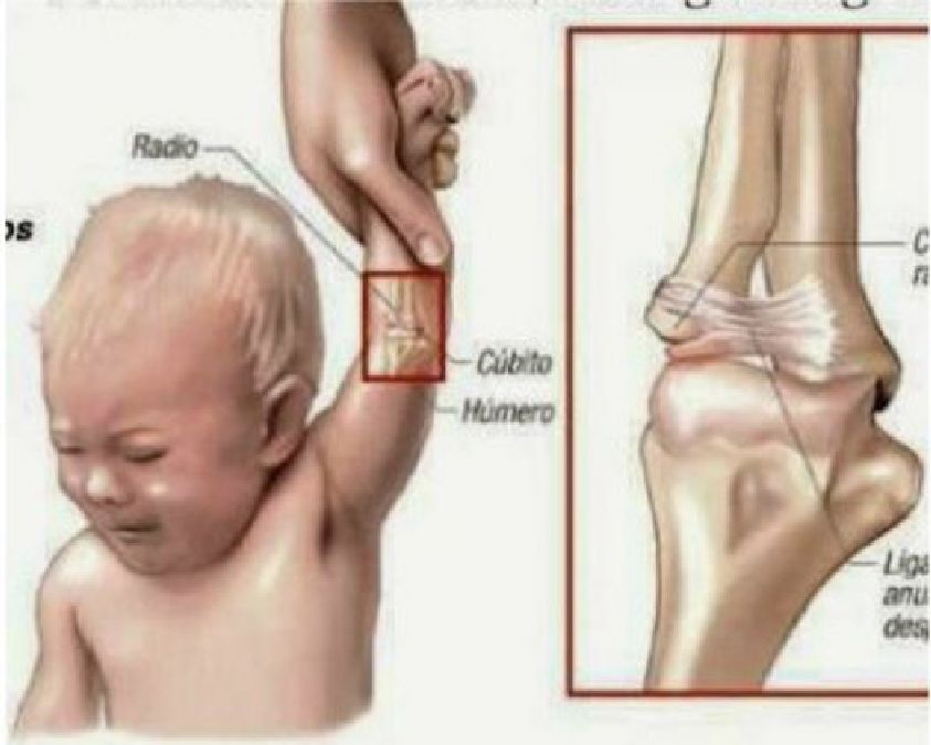 Attention à ce geste  dangereux : Voici la raison pour laquelle il ne faut jamais tirer le bras de votre enfant