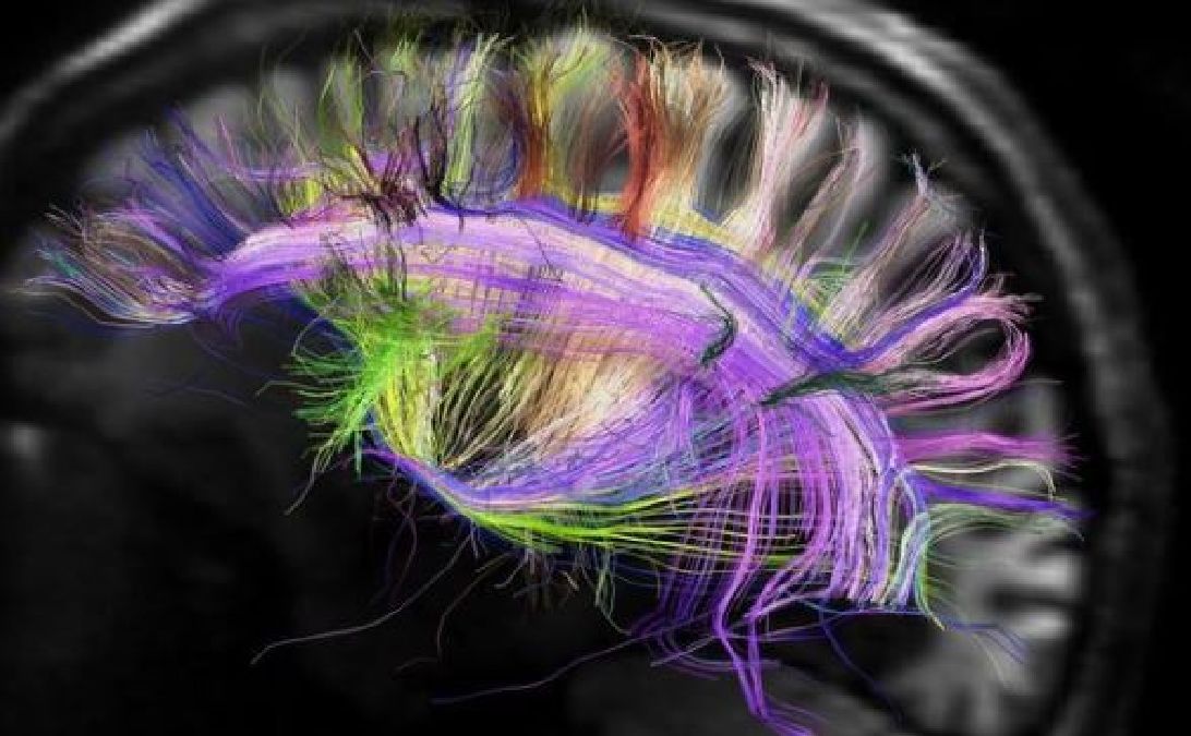 Identification d’un lien entre l’esprit et les neurones