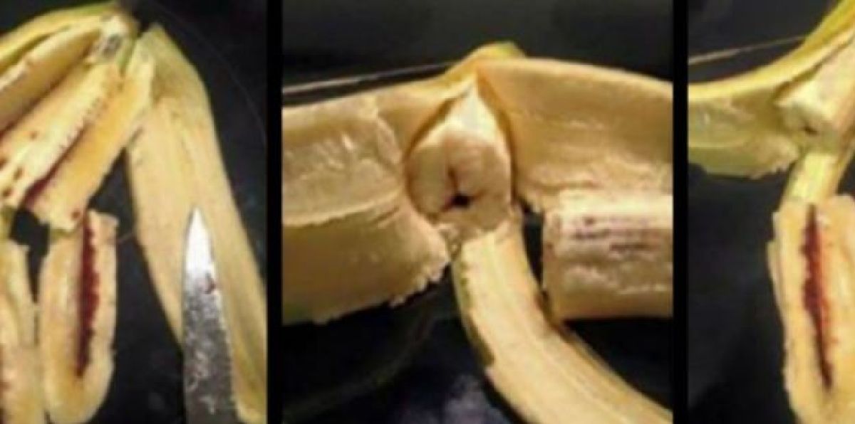 Attention : Cette fille a failli perdre la vie à cause d’une banane