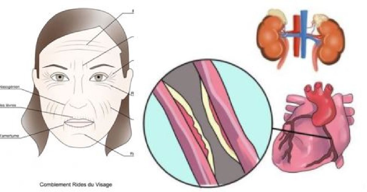 Les signes de problèmes rénaux, hormonaux et hépatiques se trouvent sur votre visage