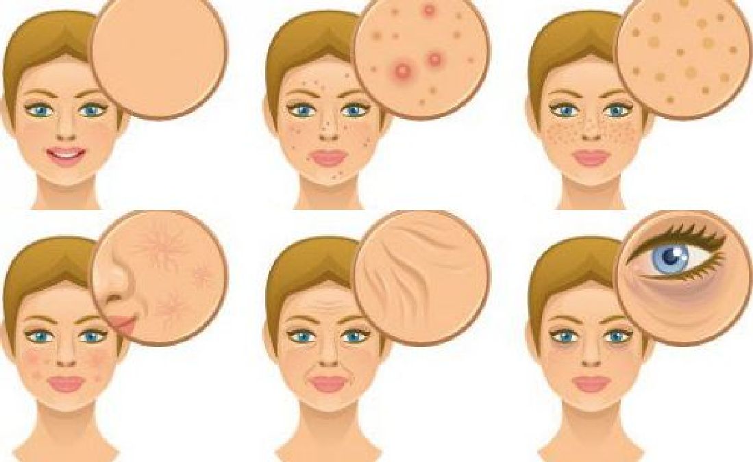 5 Carences en vitamines qui seront visible sur votre visage.